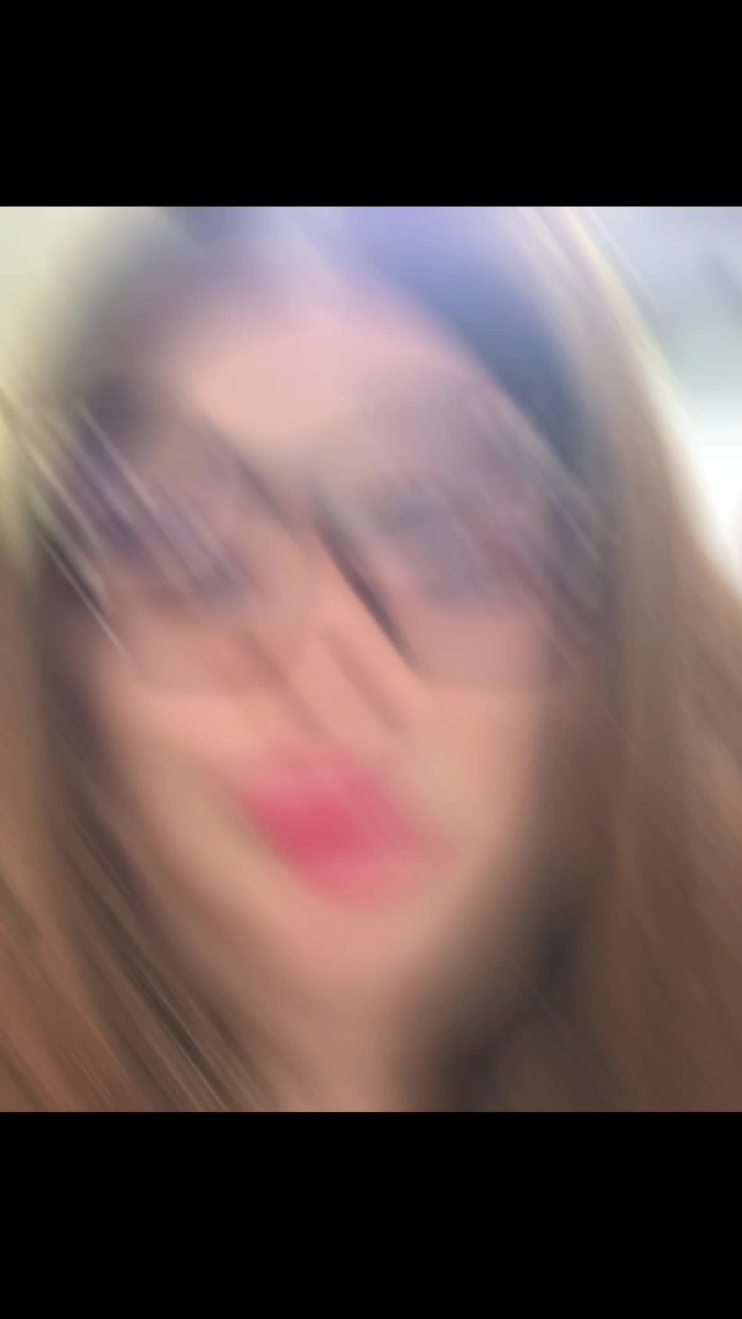 @Miss. PinkY(vitiligo girl)