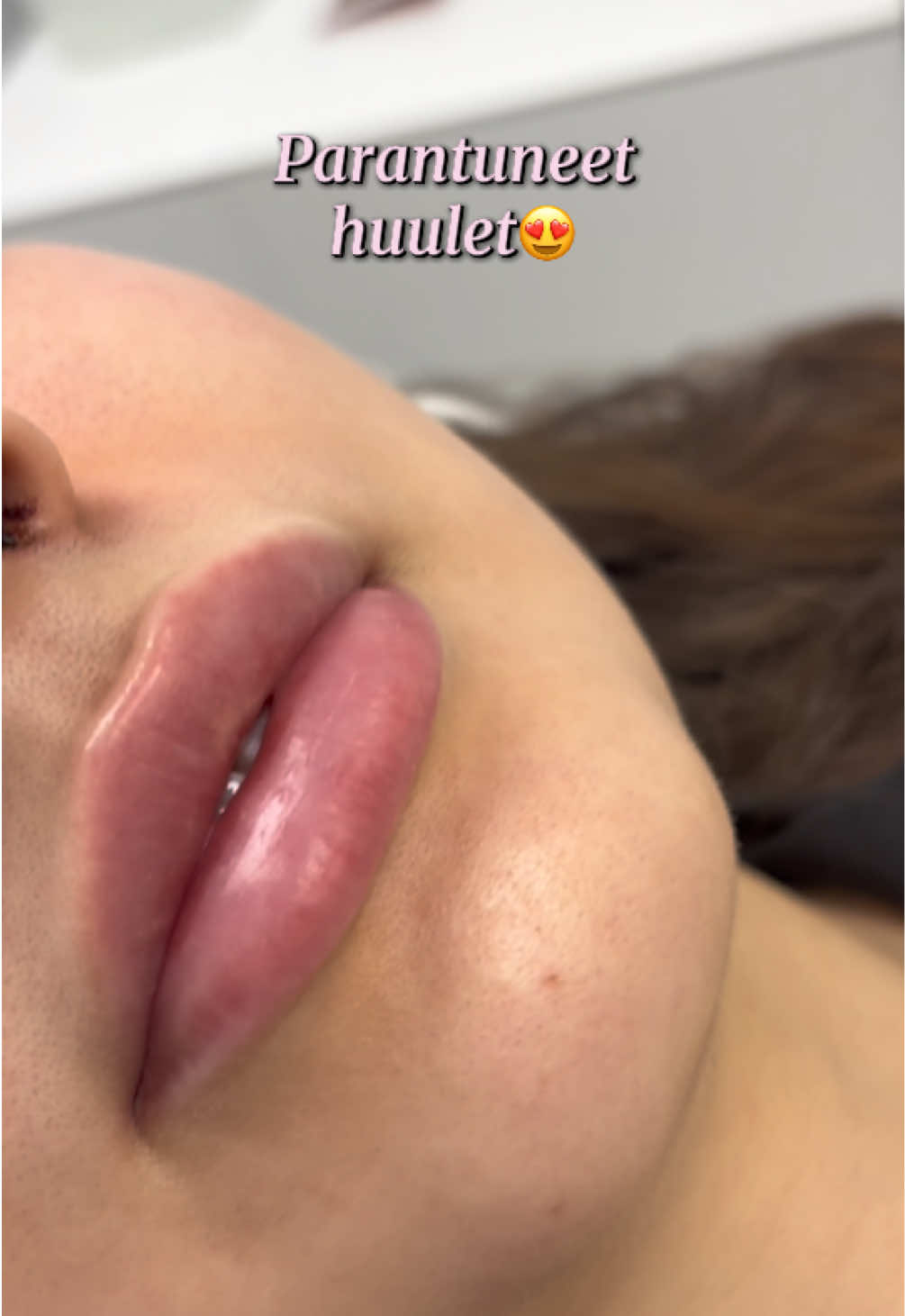 @Sairaanhoitaja Lotta 💉