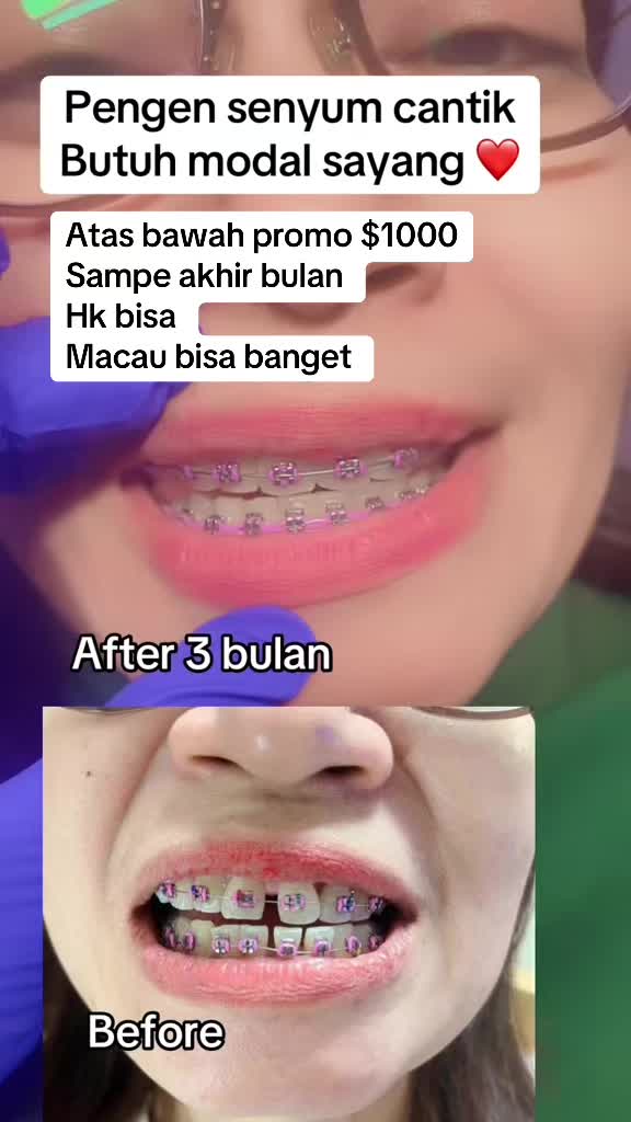 @mbak-Paijem