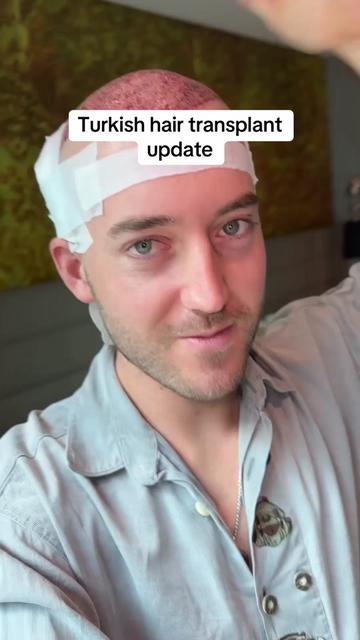 @Austriankiwi