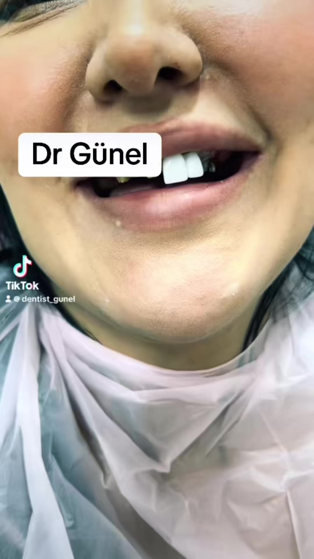 @Dentist_Günel