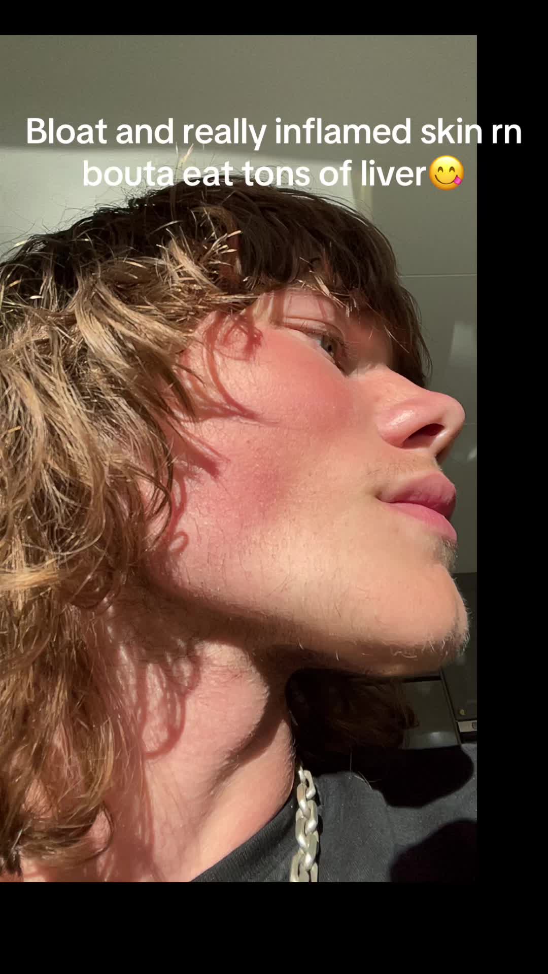 @ryggron