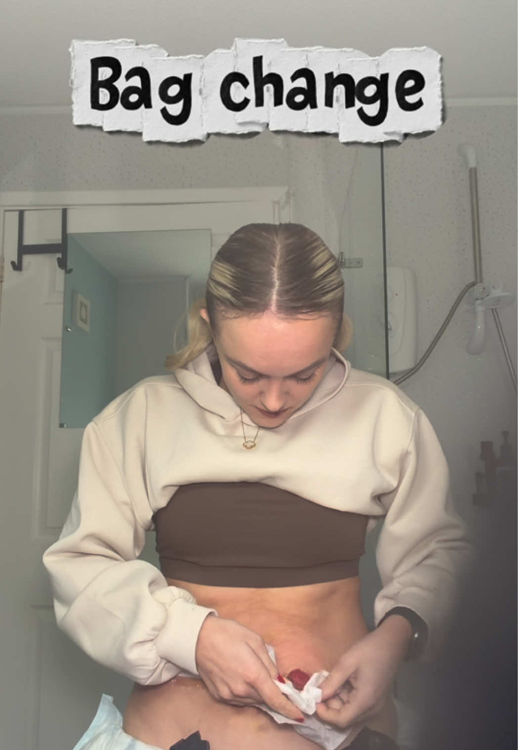 @Soph | IBD/POTS/STOMA& co🦓
