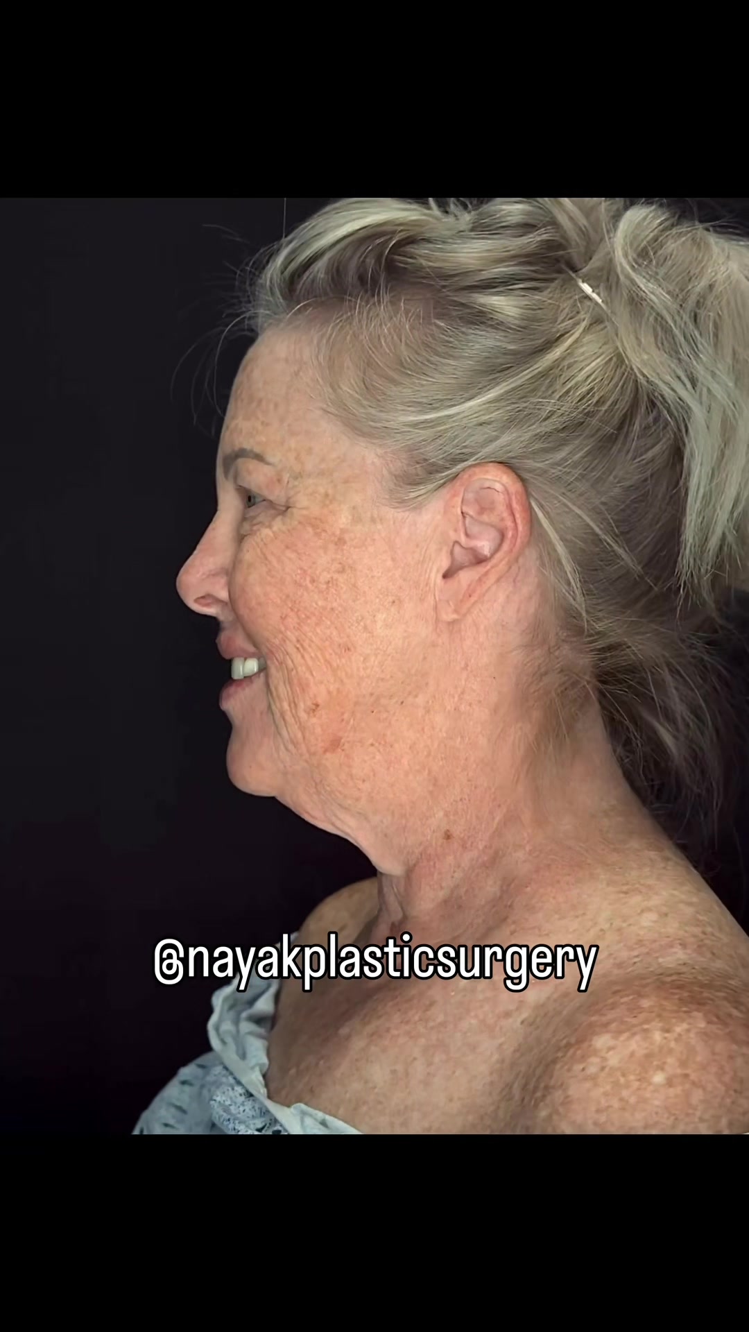 @NayakPlasticSurgery