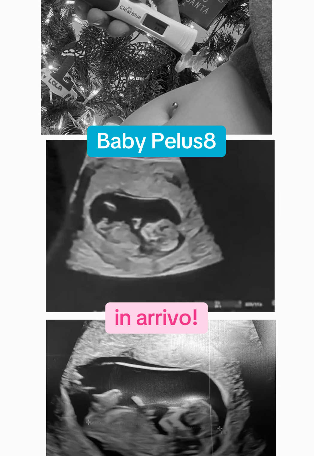 @❤️ Mom of baby Pelus8 🩵