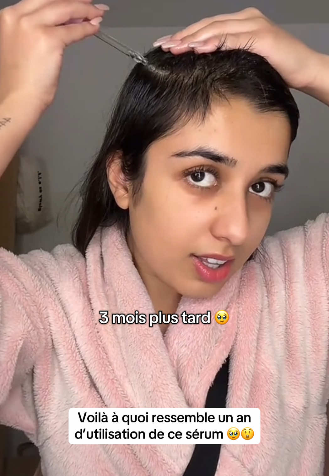 @Lux’Hair Growth