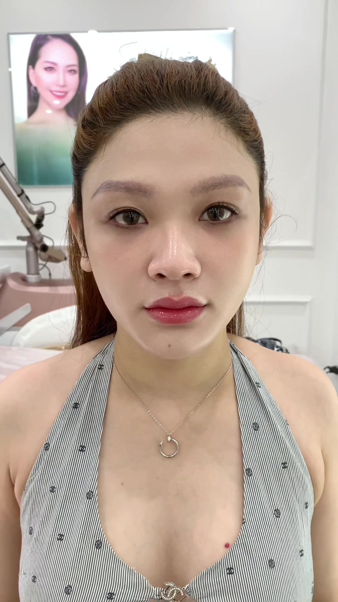 @Viện Thẩm Mỹ Hena