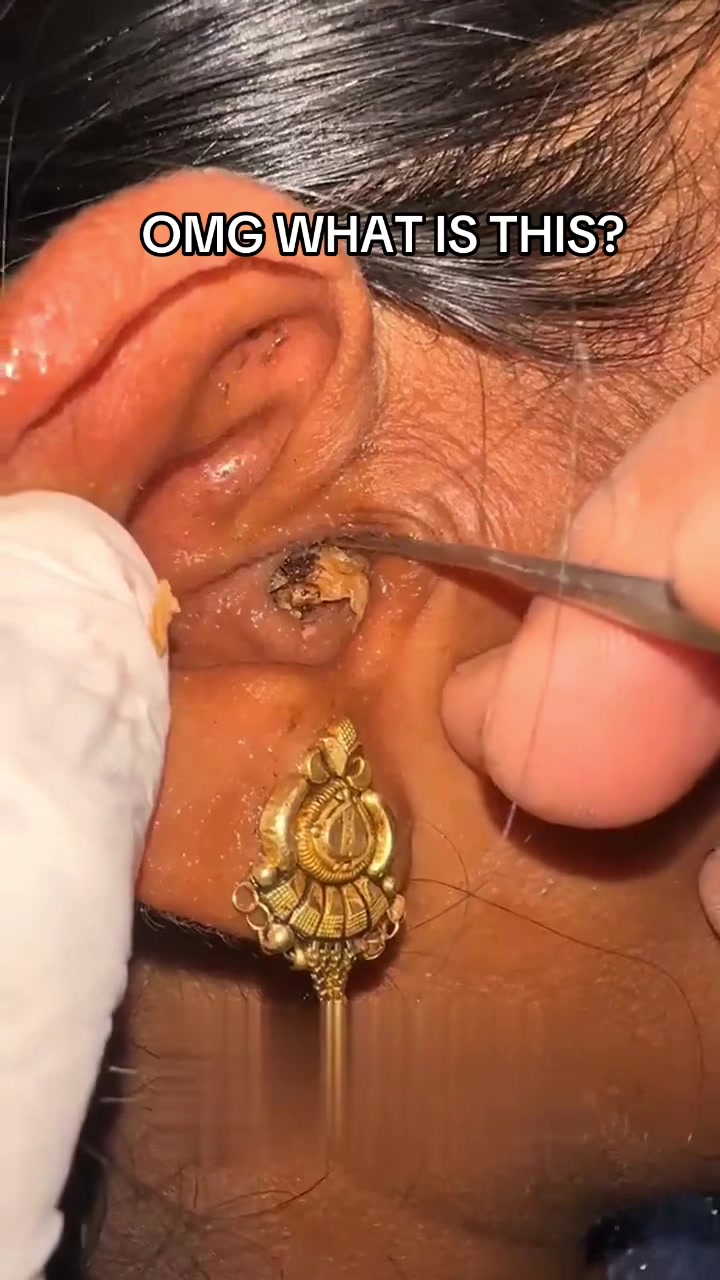 @Satisfying Ear Cleaning Videos