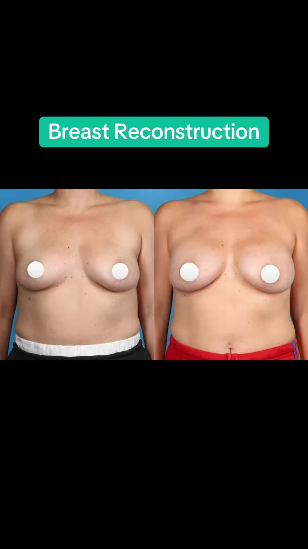 @Kelly&ensp;Killeen,&ensp;MD,&ensp;FACS
