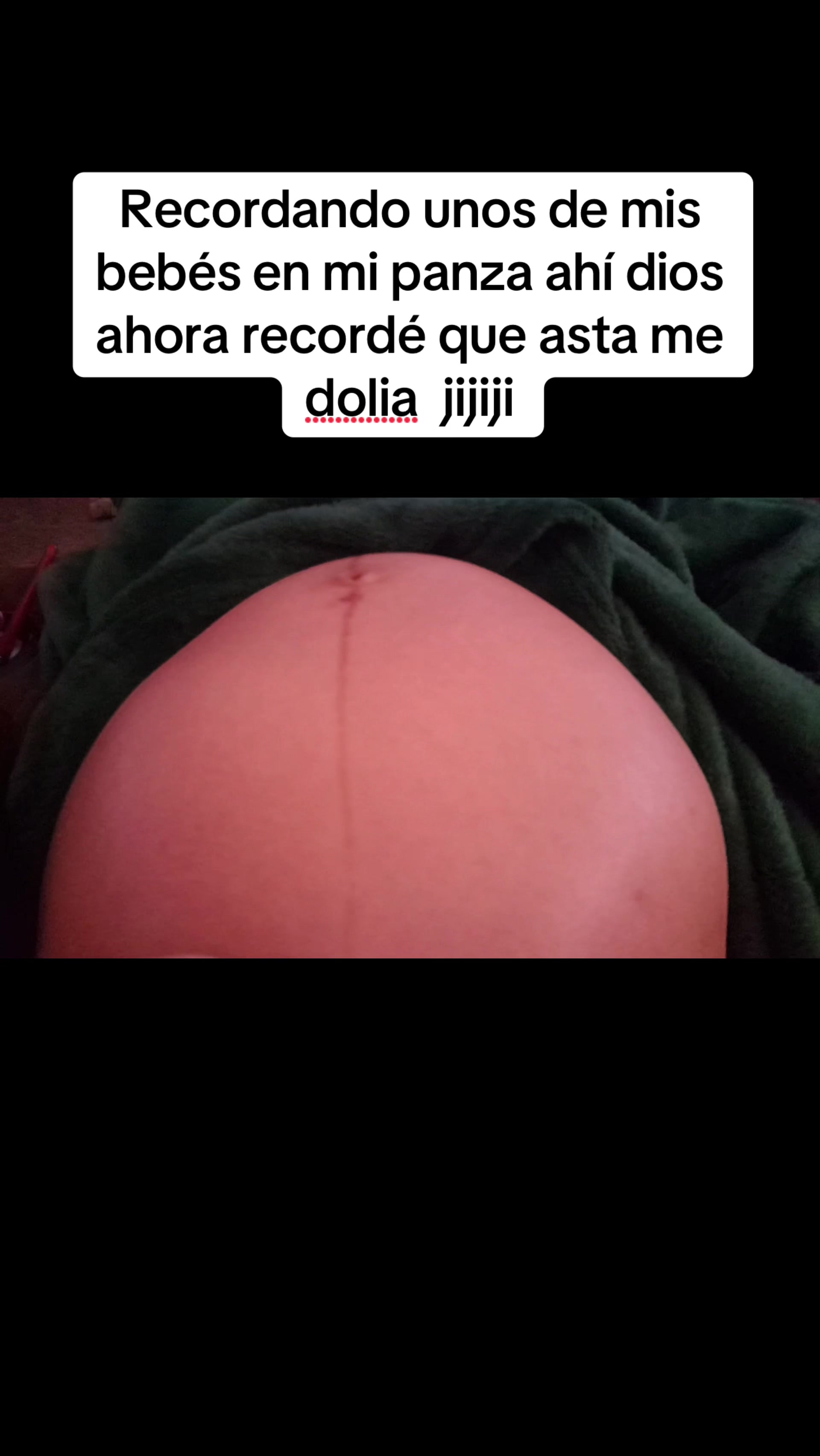 @🎀🎀 Peque💝💞