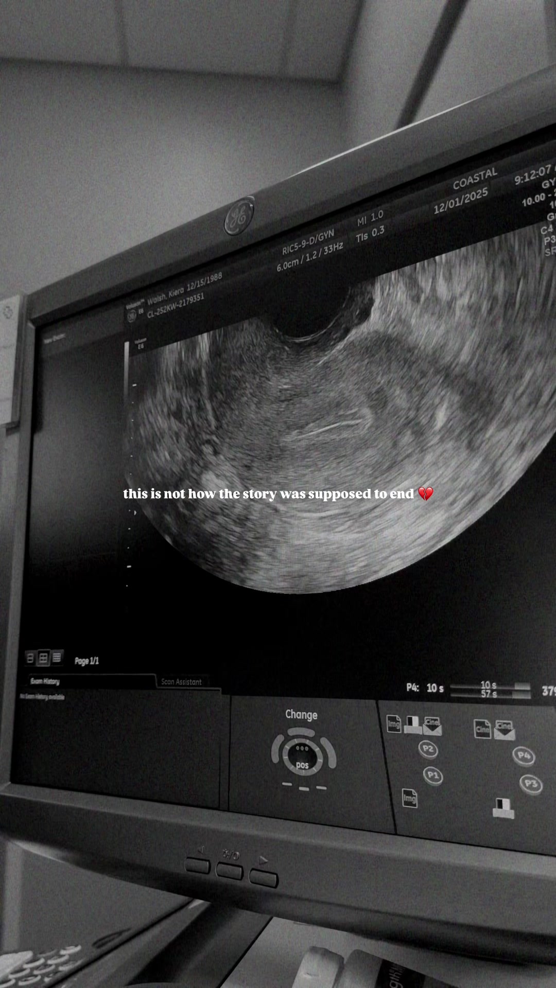 @Kiera | Gestational Surrogate