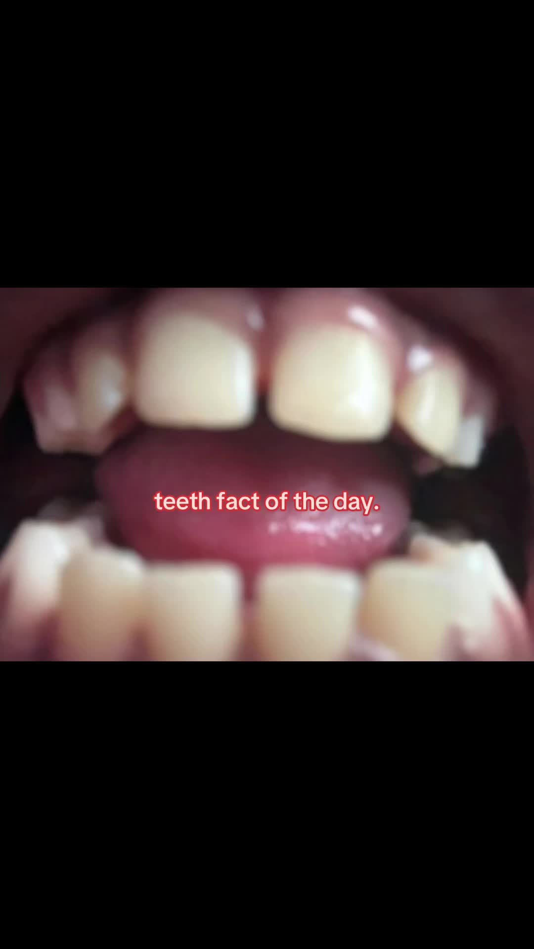 @I leik teeth moer thna mysefl.
