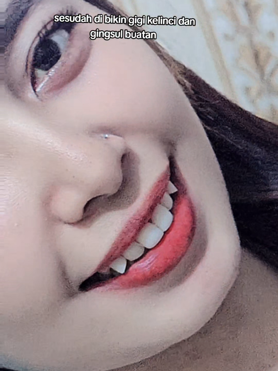 @Fiqygigi