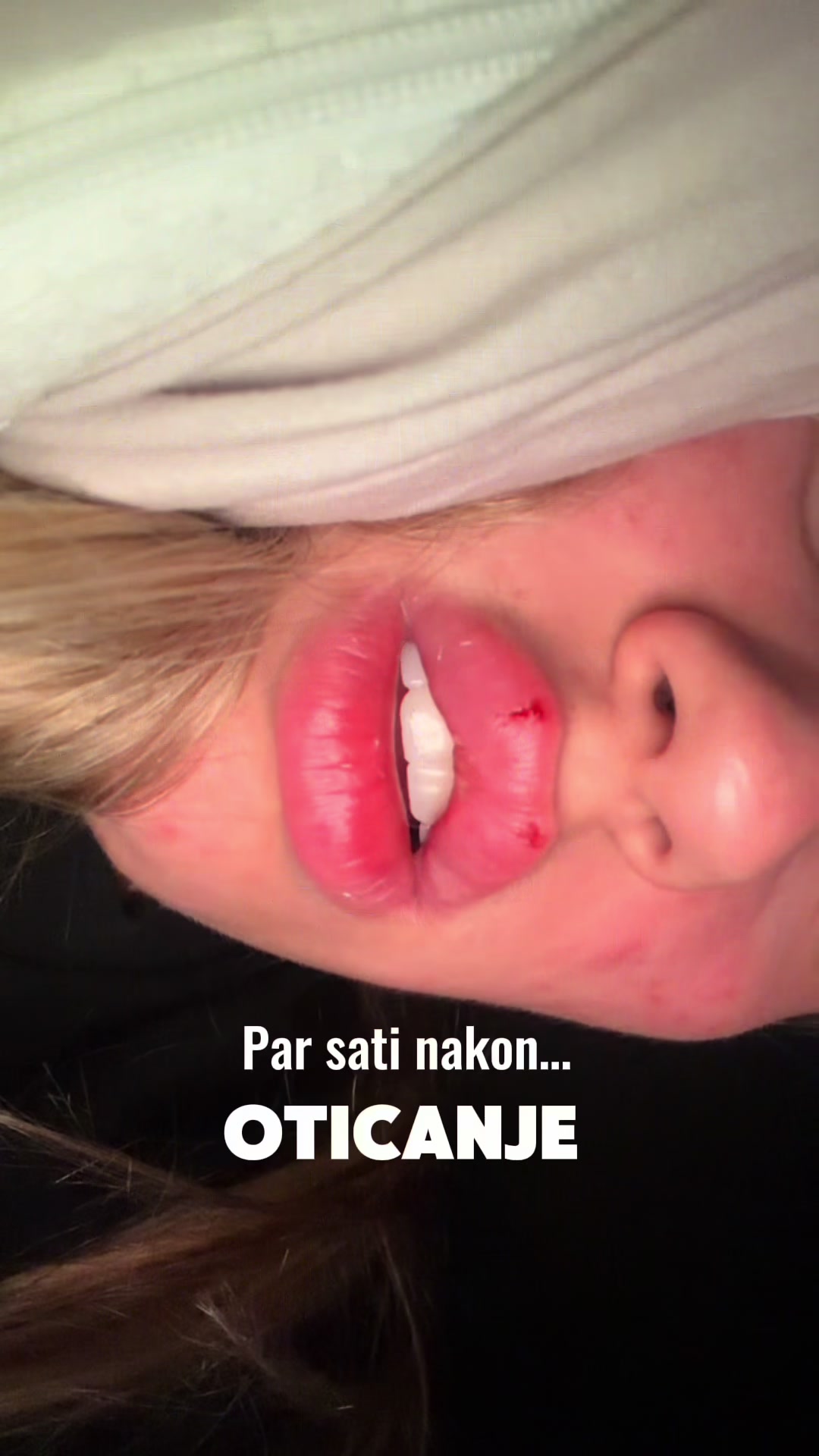 @IVA