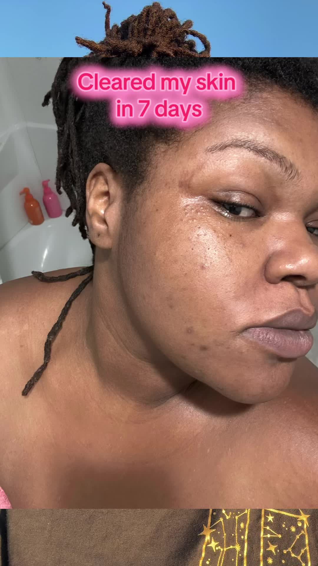 @BreadfruitGaal