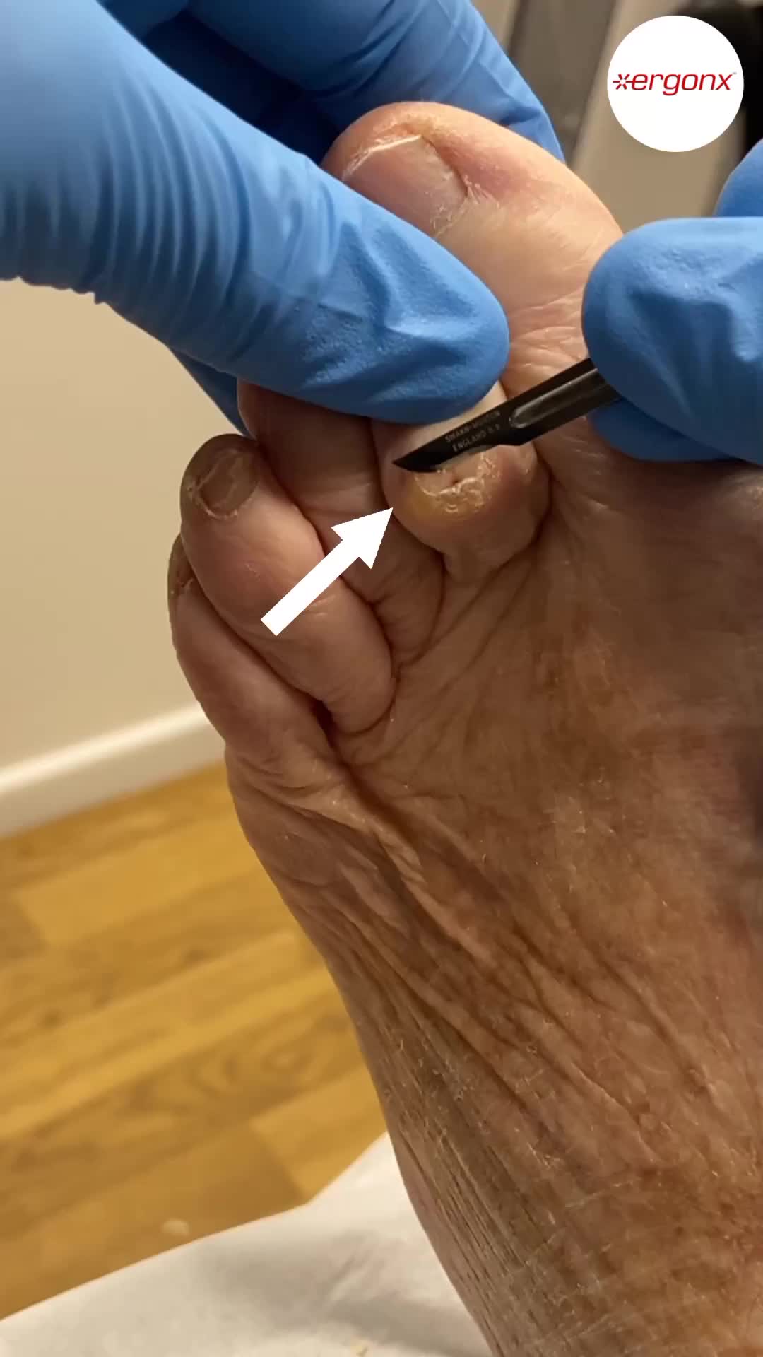 @ergonx