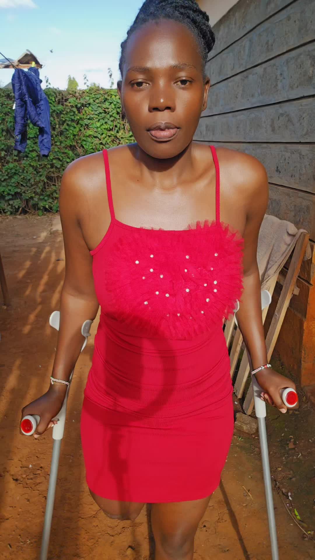 @💎Nattie Amputee🇰🇪♊️