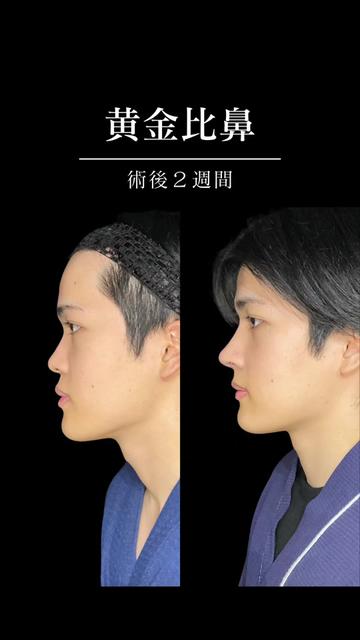 @ソ院長(バウム美容外科/トータル整形)