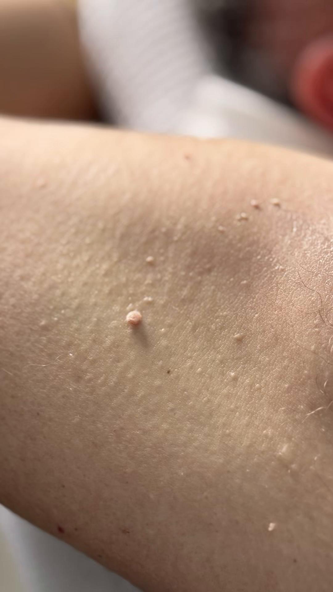 @DivaLaserCentar