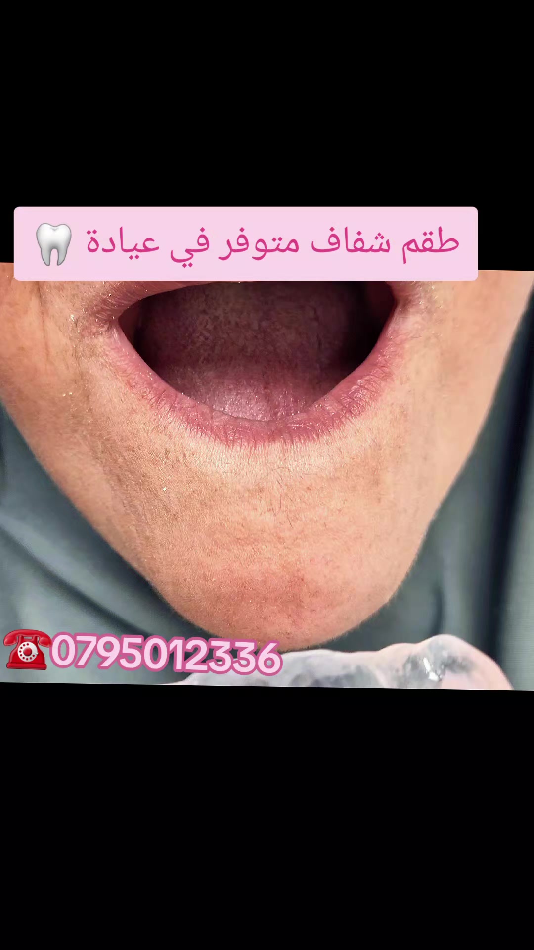 @Dr otmani. A 🦷🖤