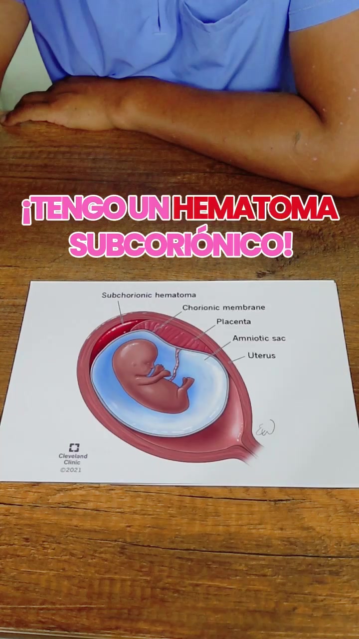 @InnataSurco📱914930002