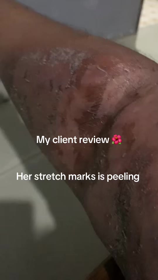 @@ Precious peeling soap