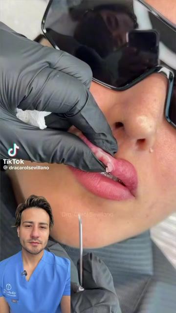@chrisantiage