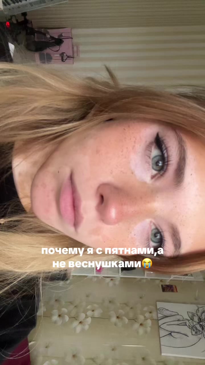 @ТГК: ПЯТНИСТАЯ БРО