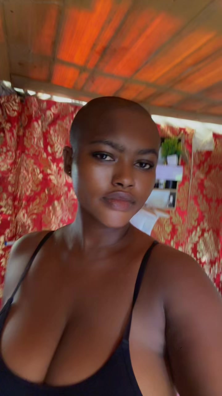 @Baldheadgirl
