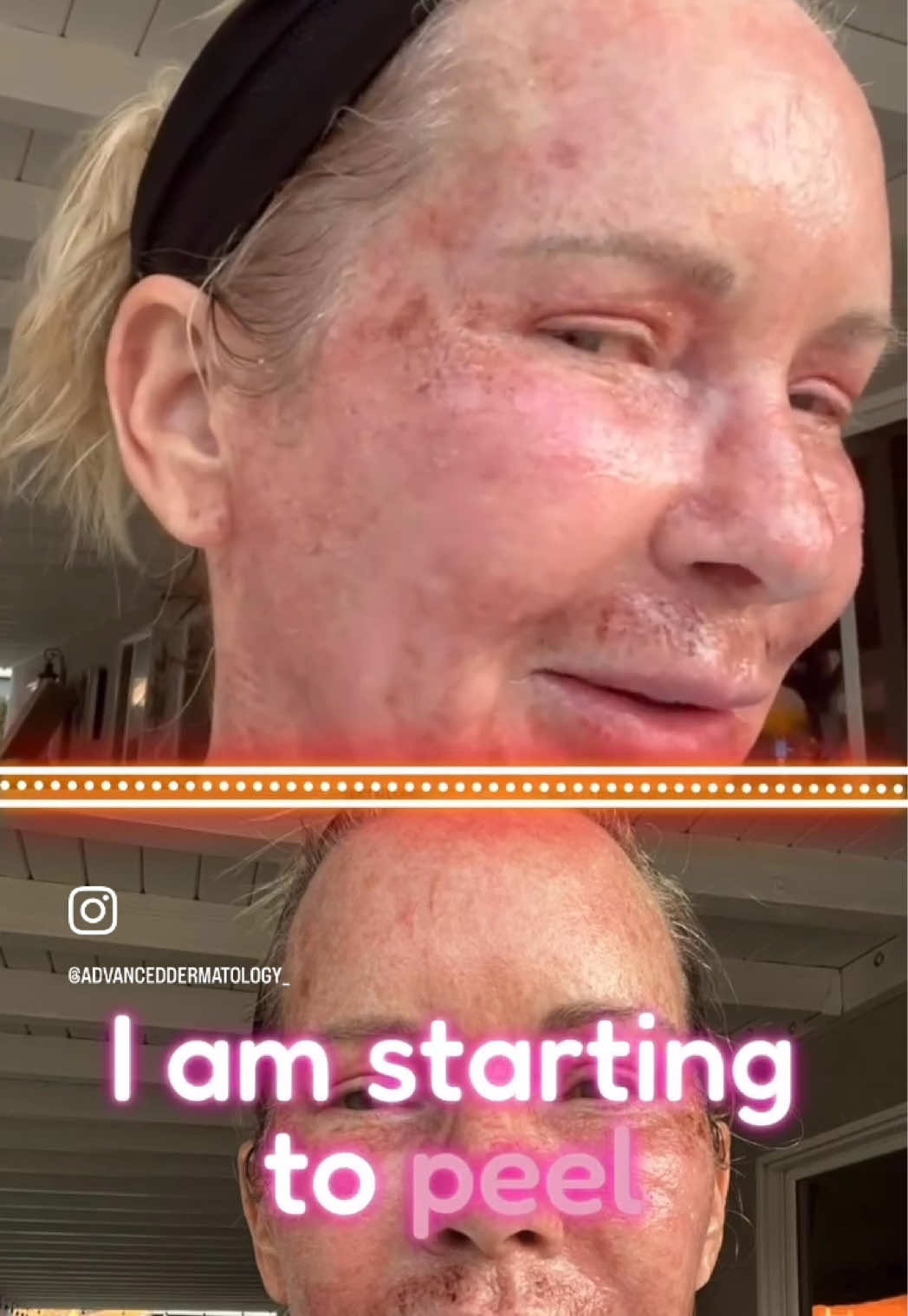 @AdvancedDermatology661