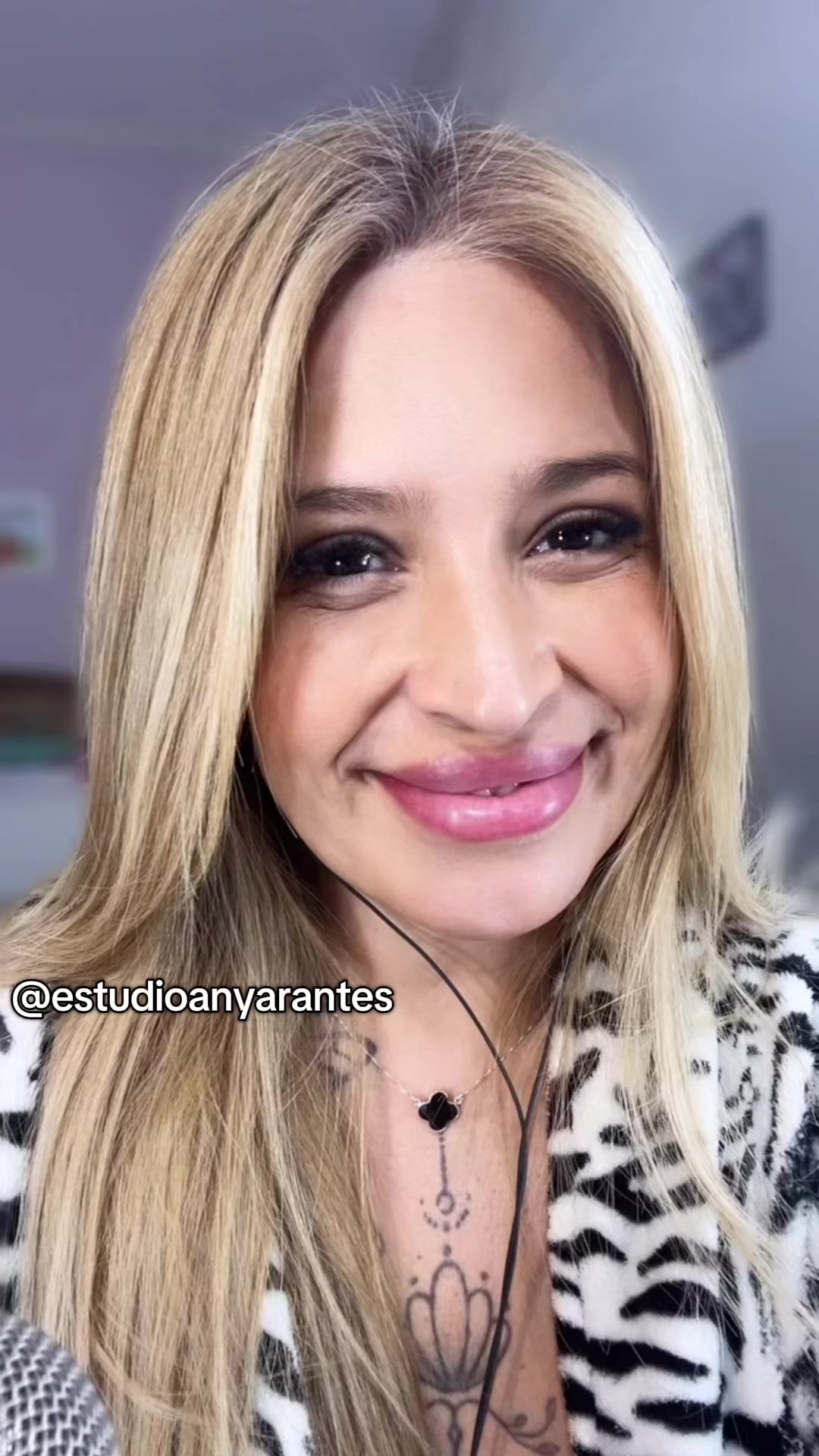 @Any Arantes