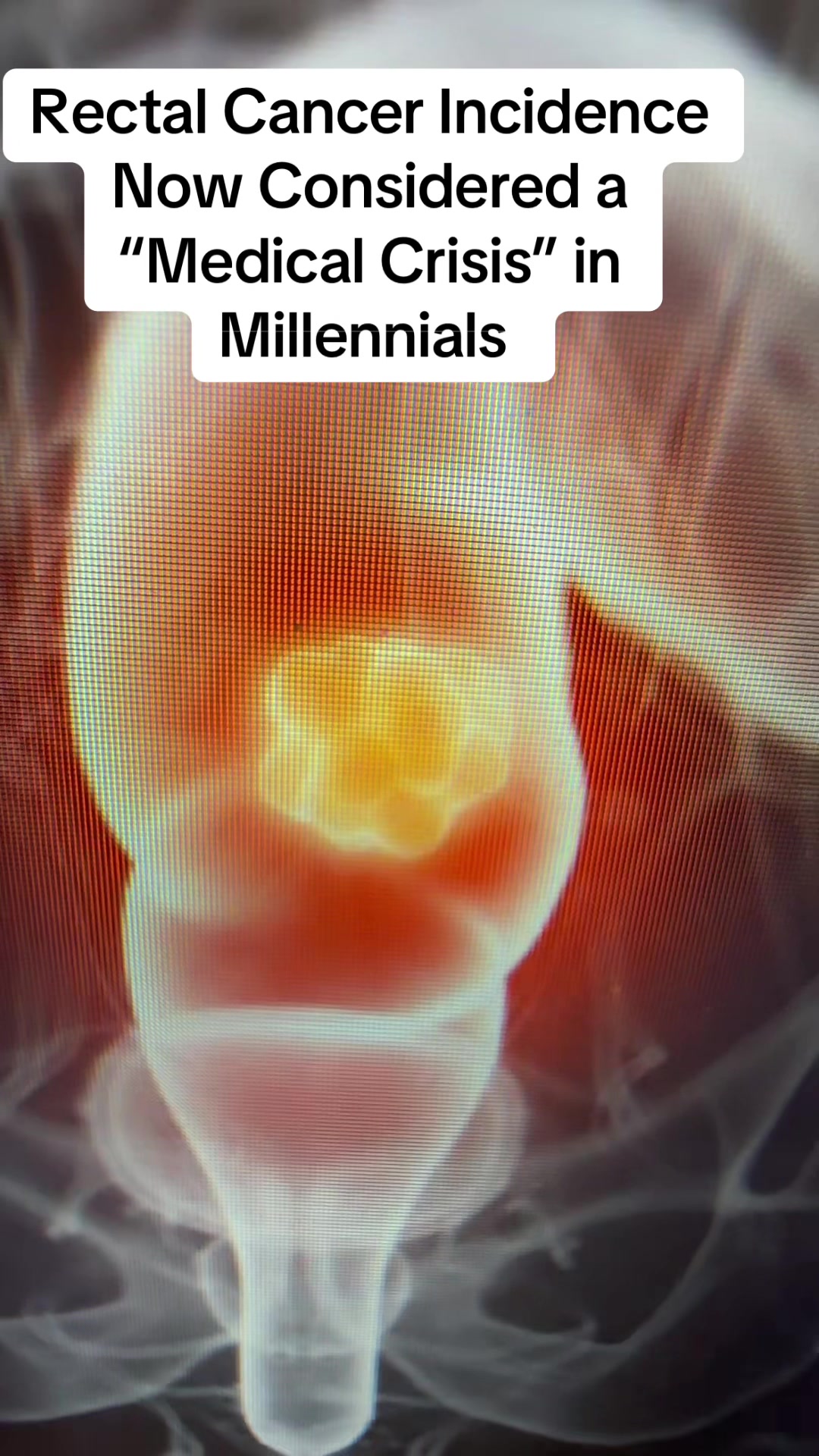 @joe_piankamd_author