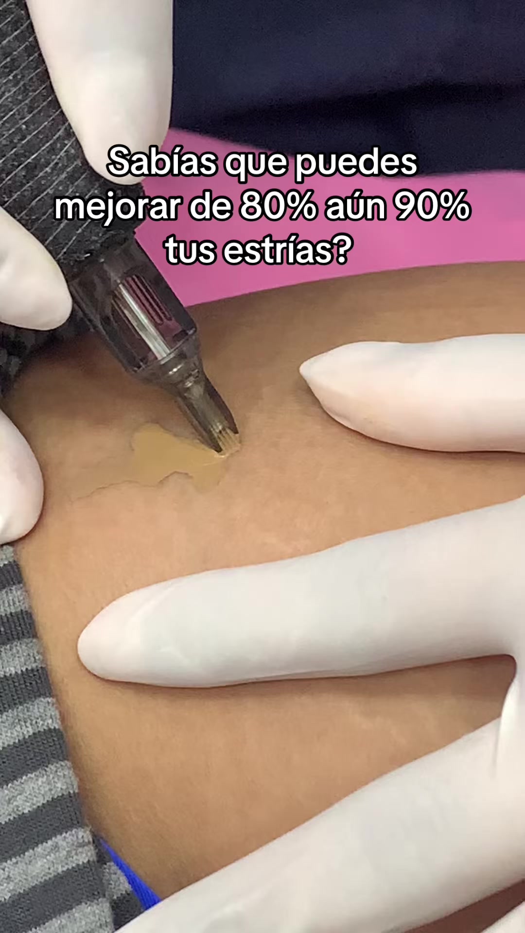 @Carla Panchana
