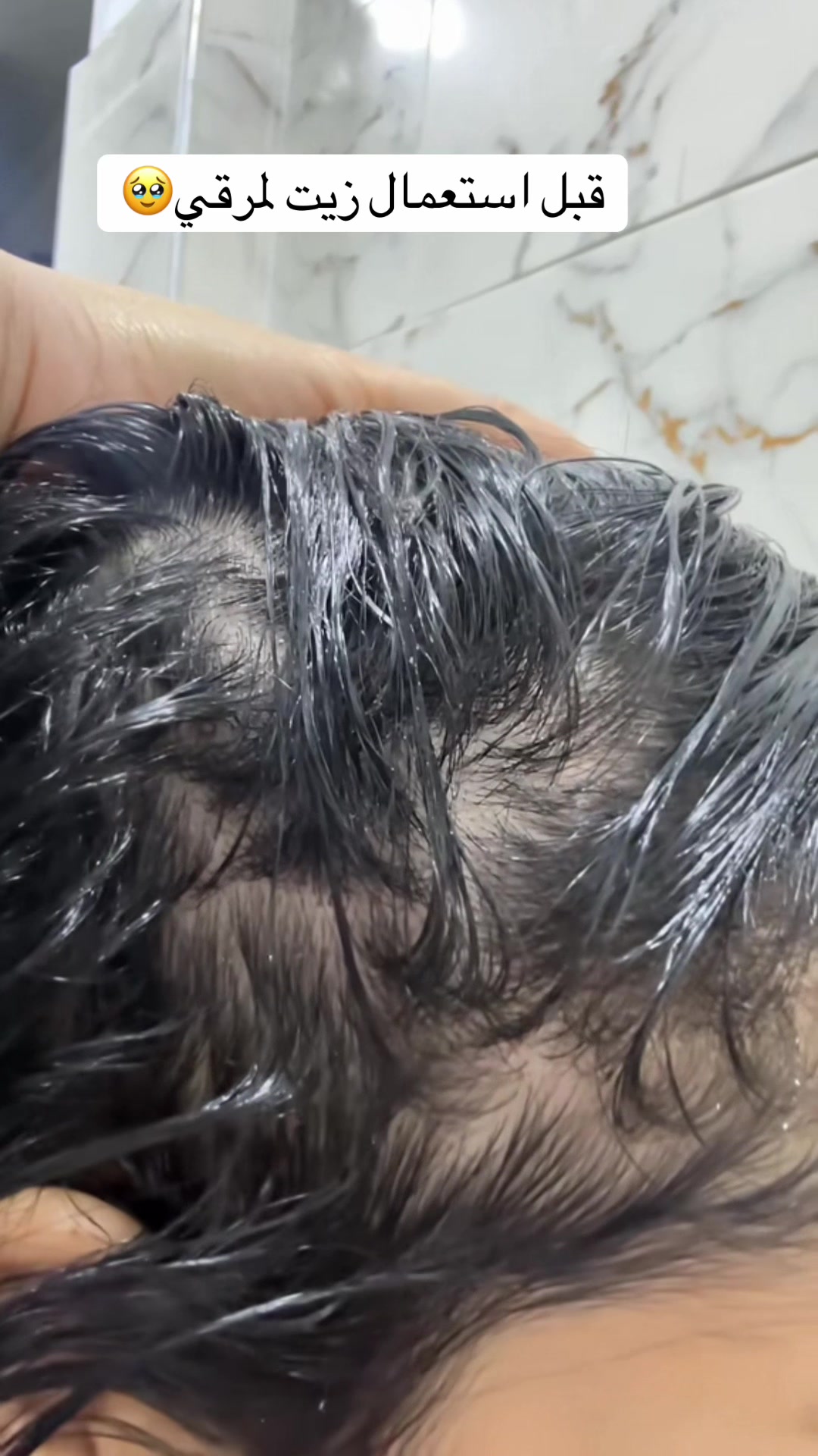 @๐๐ูุฑู______ุฒุฉุงููููุทุฑูู๐๐