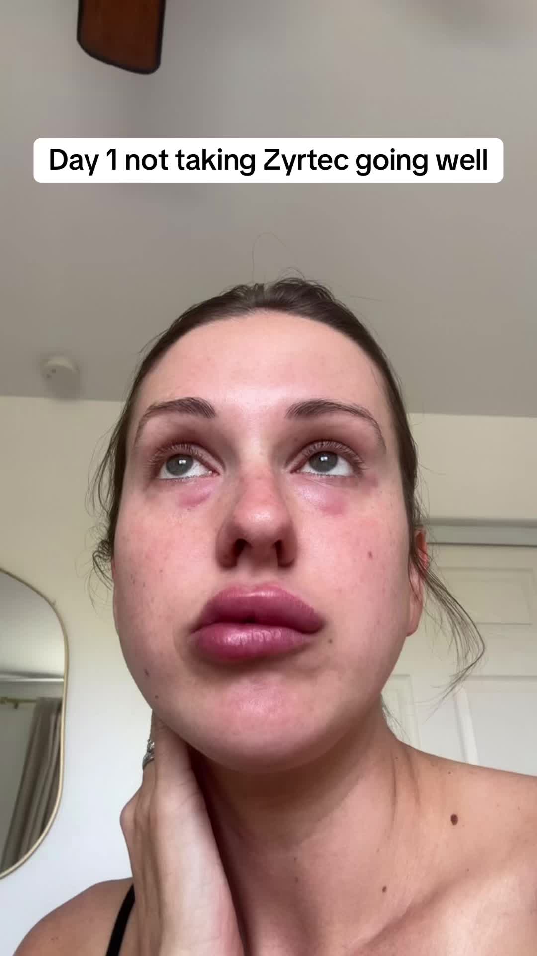 @allergygirl_