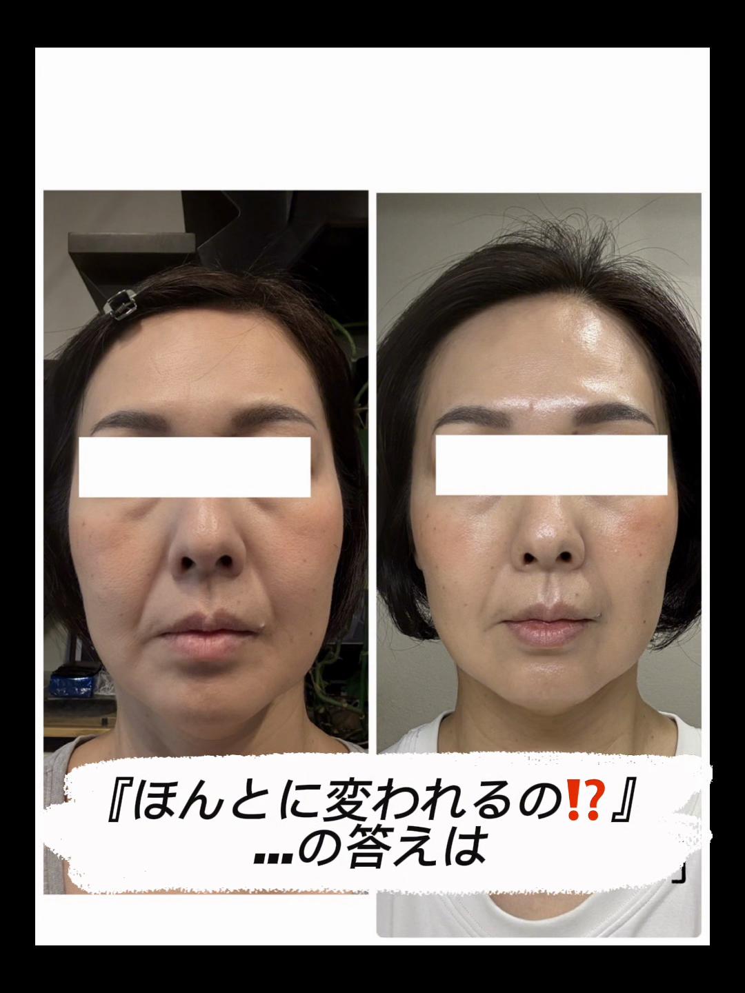 @ピロ/表情筋トレーナー/fgm認定講師