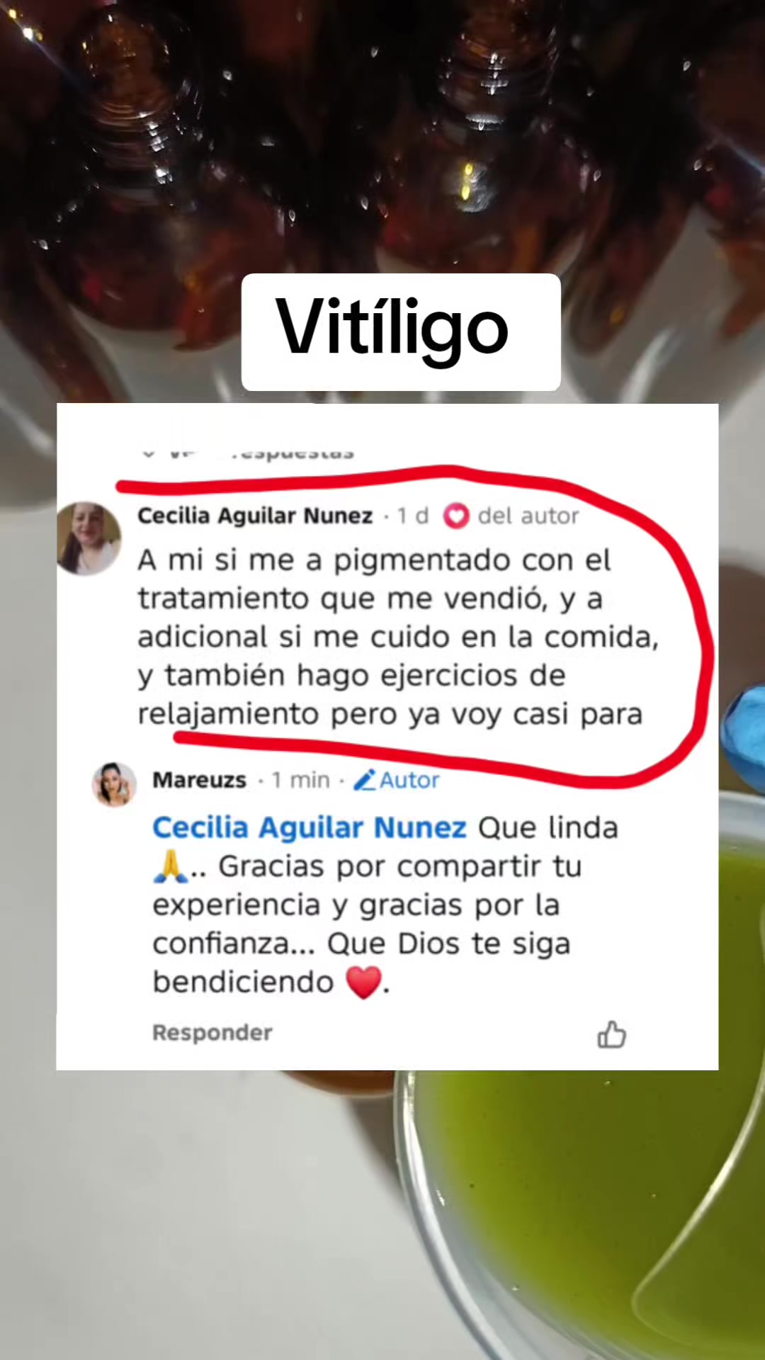 @Mareuzs
