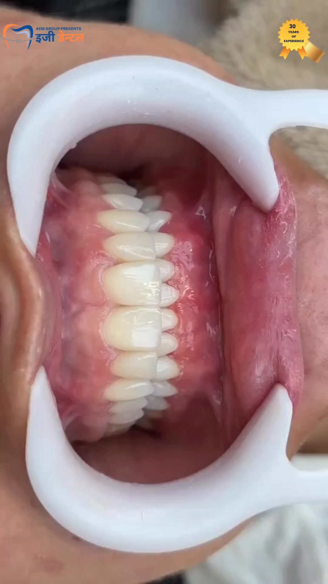 @Easy Dental