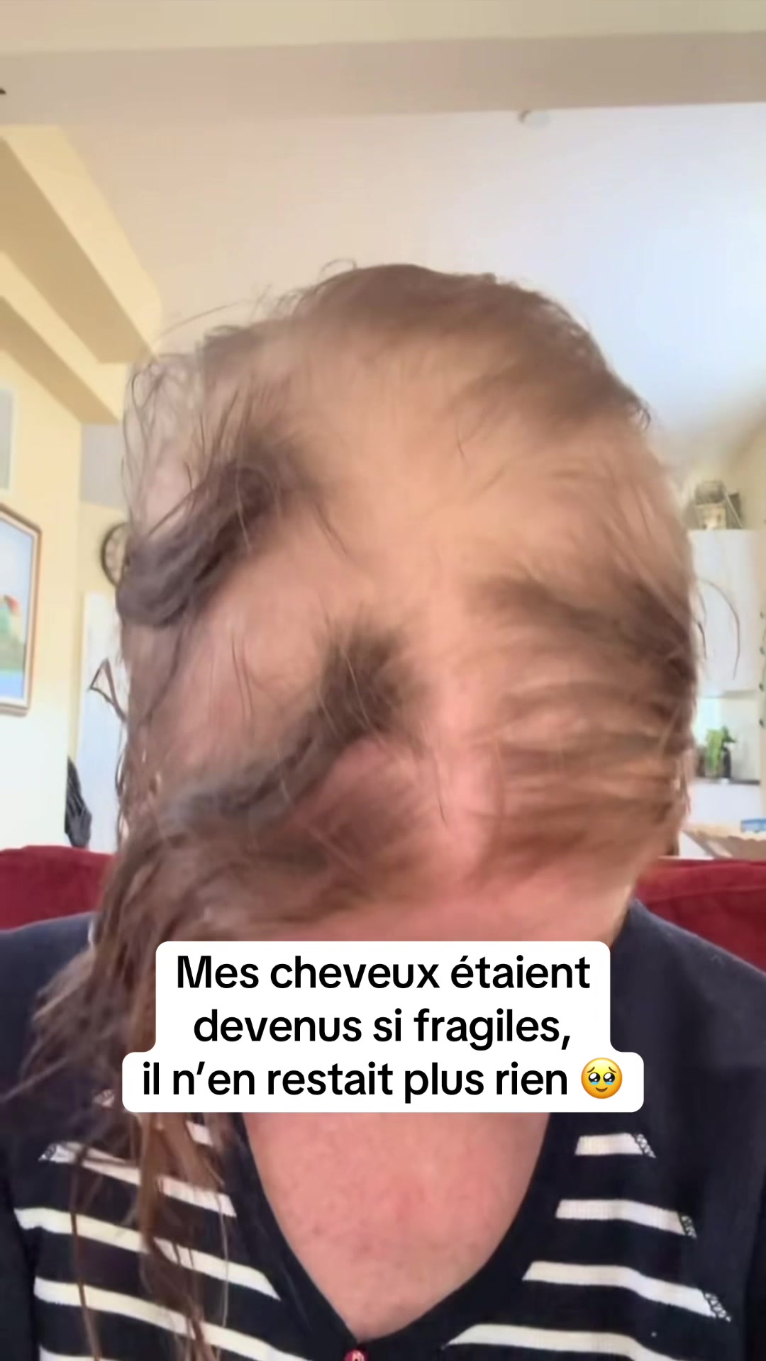@Lux&rsquo;Hair Growth