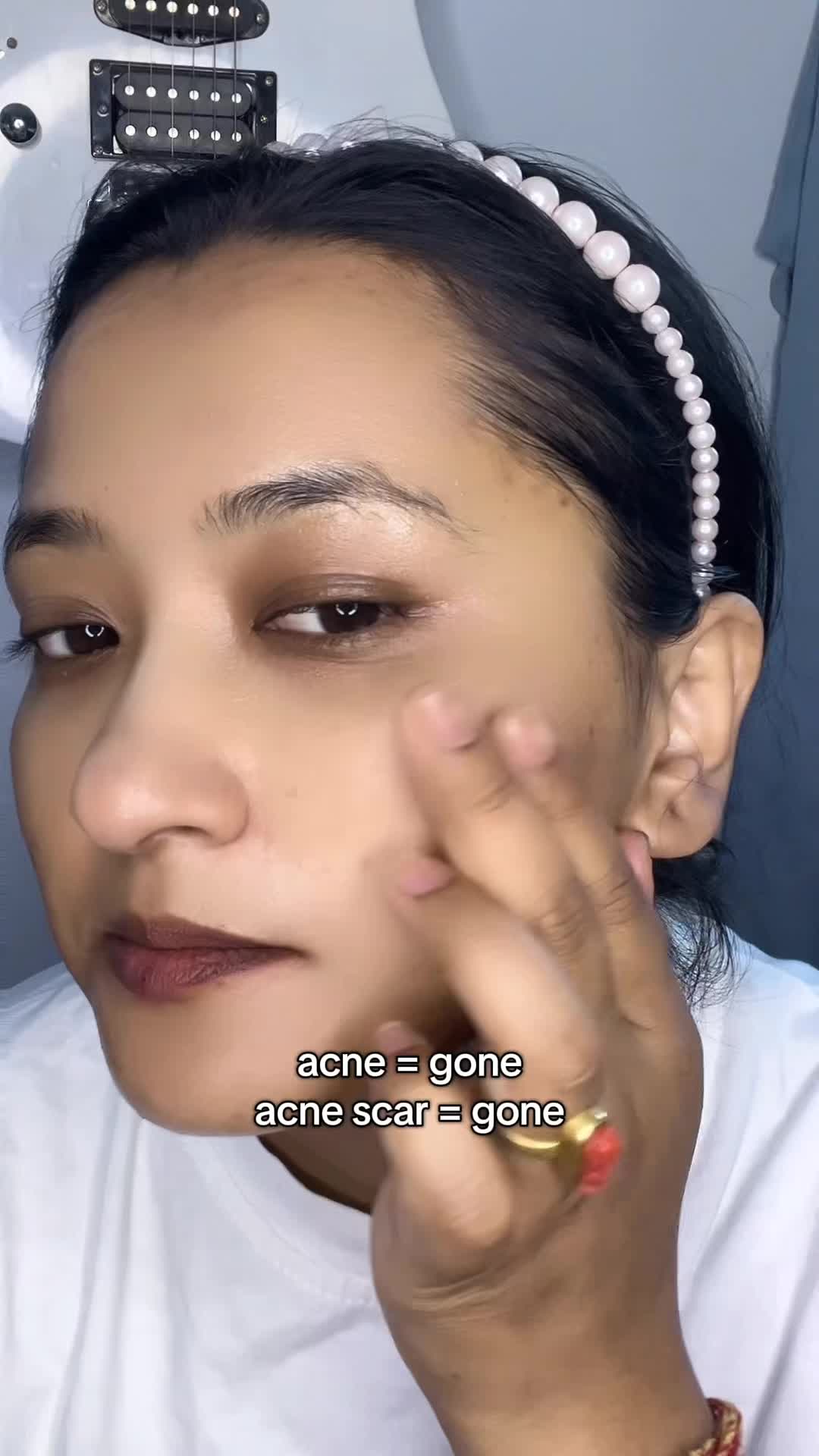 @Anuradha