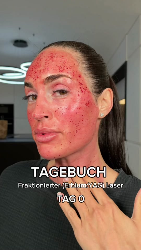 @Melissa | BEAUTYEXPERT