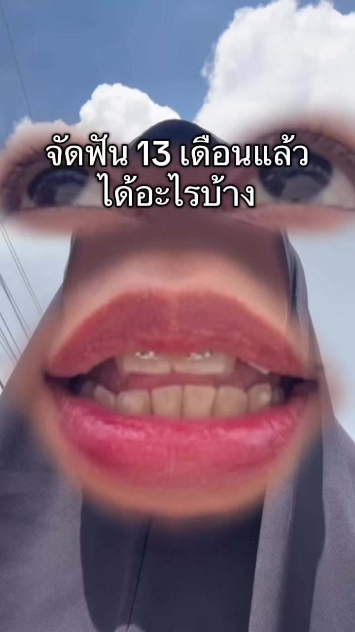 @ฟาตินฟันกระต่ายอ้ะะ🐰