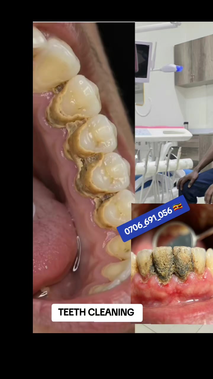 @Dental studio.🦷.Kampala