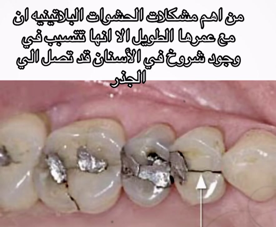 @Dr.Manar Samy