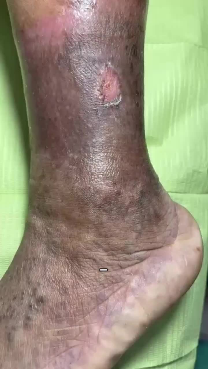 @Dr. Tomás Cortez