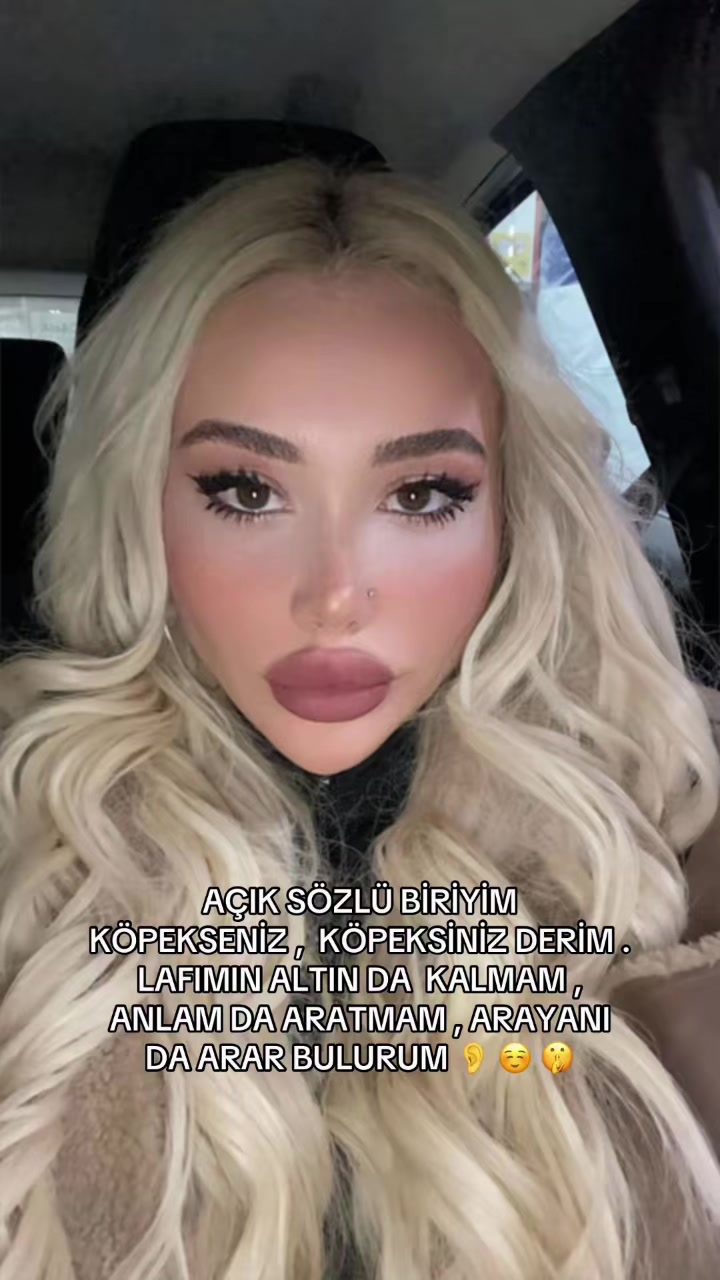 @PELONUZ