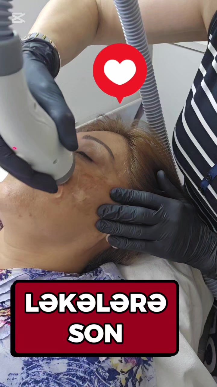 @ehmedli_kosmetoloq_lazeroloq