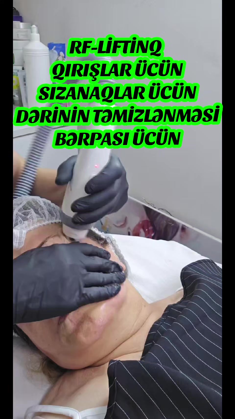 @ehmedli_kosmetoloq_lazeroloq