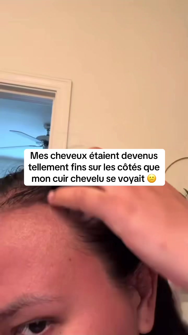 @Lux’Hair Growth