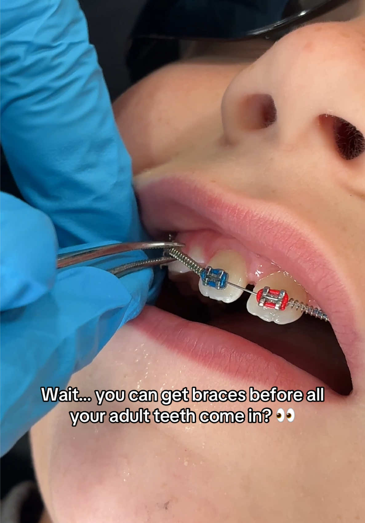 @Woodland Hills Orthodontist